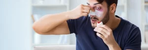 Precio de una rinoplastia en Cartagena - Actualizados!